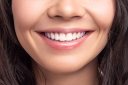 5 Tips for Keeping Your Teeth White after a Whitening Treatment-3669364a