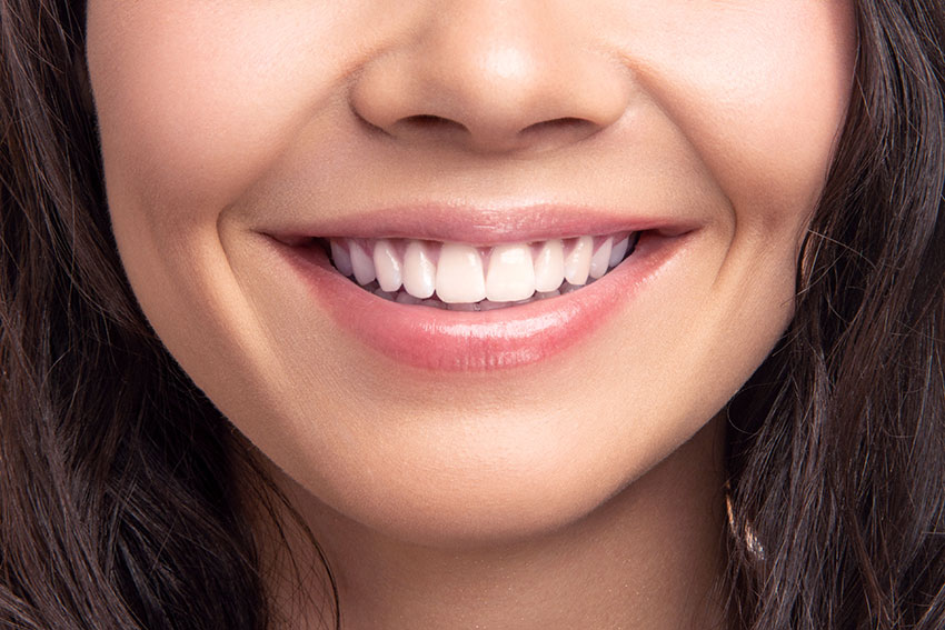 5 Tips for Keeping Your Teeth White after a Whitening Treatment-3669364a