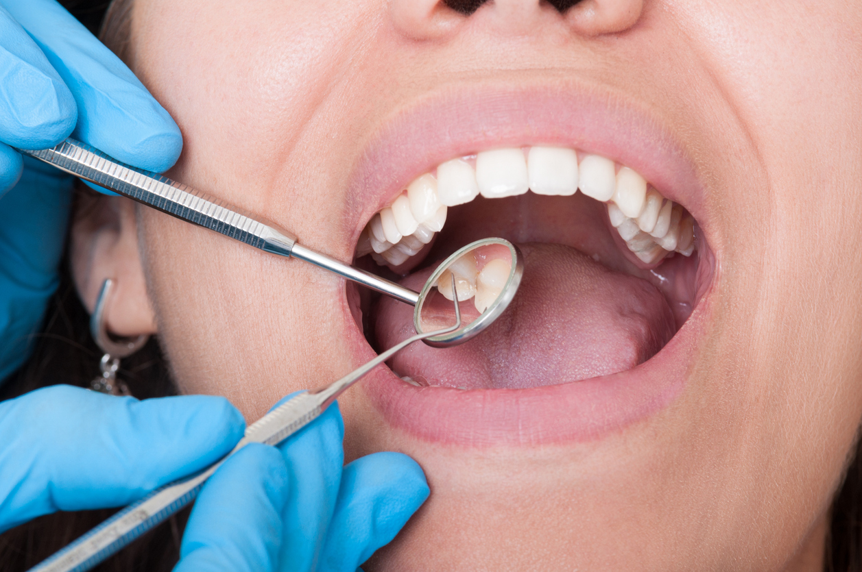 7 Oral Issues That Can Be Caused by Poor Oral Hygiene-47217974