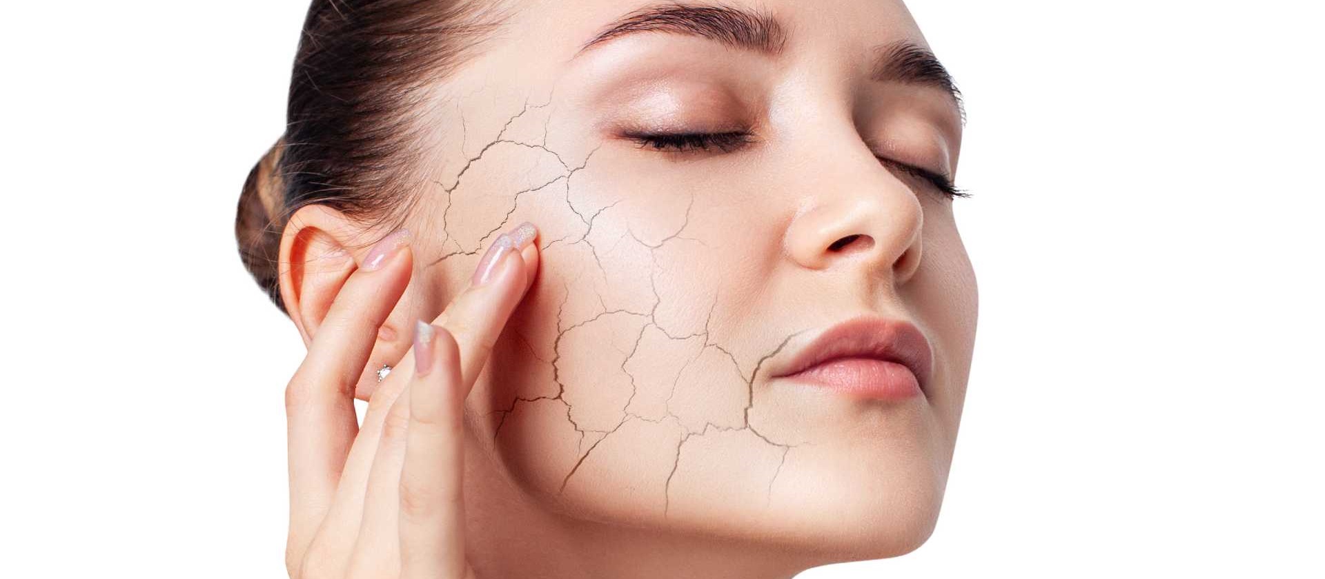 Beat the Heat Essential Tips for Managing Dry Skin This Summer