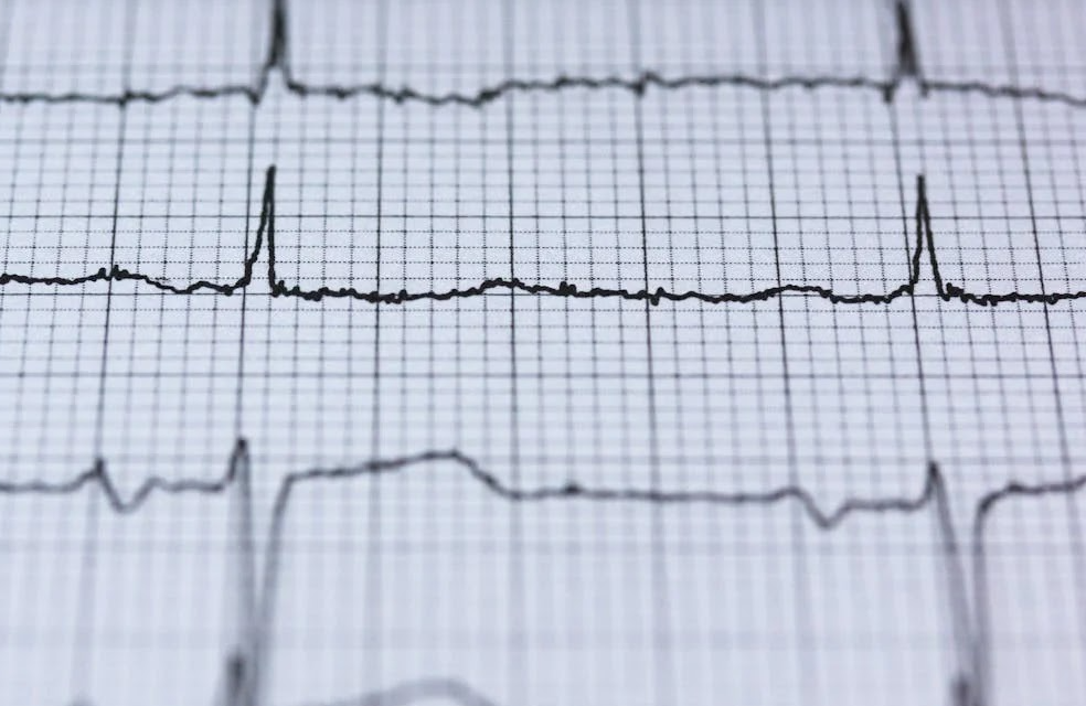 What Is Nuclear Stress Testing